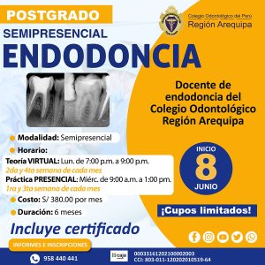 Endodoncia